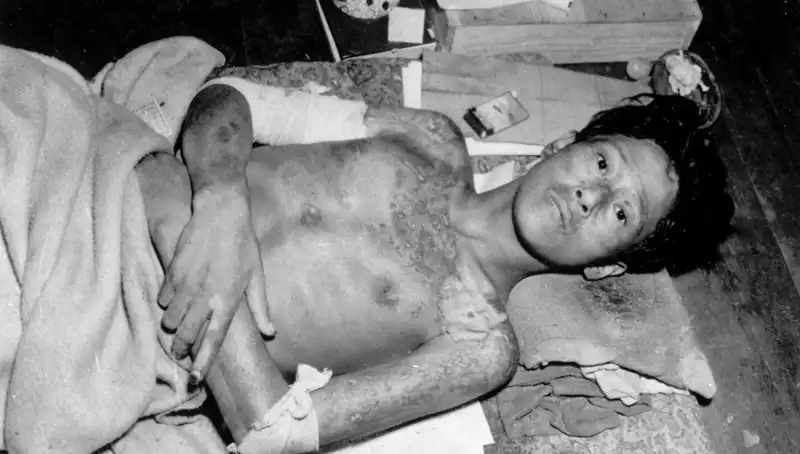 80 Yıl Sonra Nagasaki’den Gelen Uyarı: Nükleer Felaket Tehdidi Hızla Yaklaşıyor