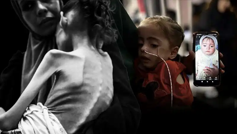 Meryem’in Hikayesi: 25 Kilodan 10 Kiloya Düşerken Yaşam Mücadelesi