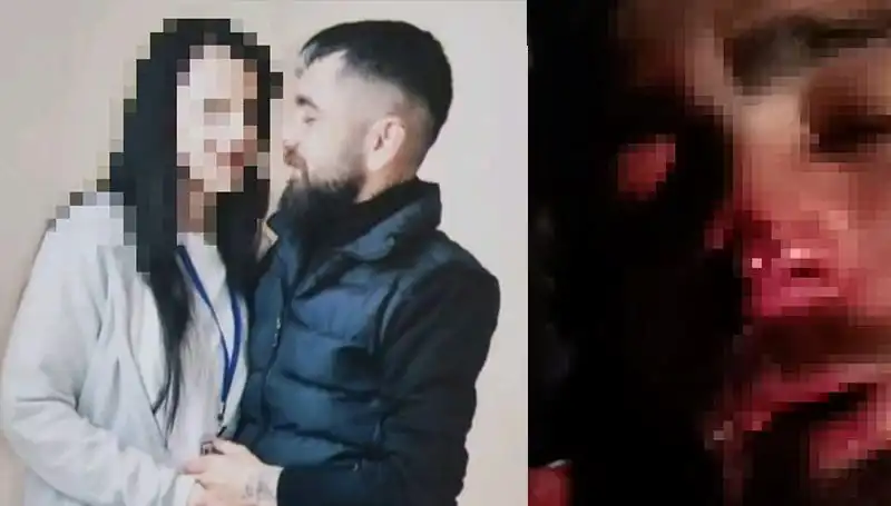 Eski Sevgiliye Dehşet: Abisi Kulağını ve Burnunu Kopardı